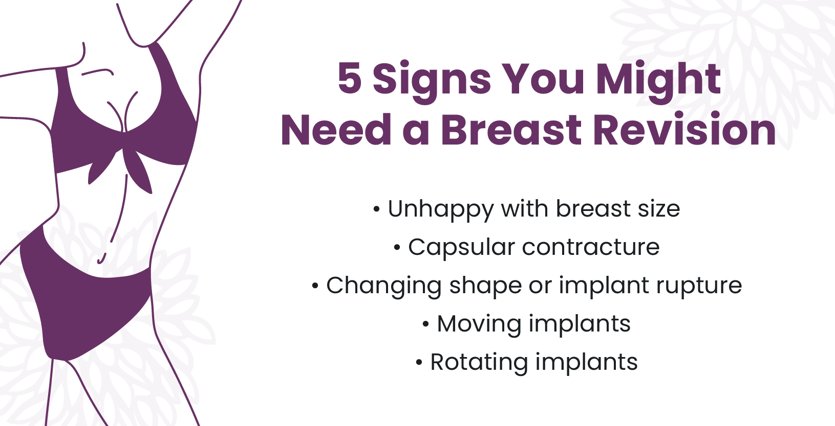 5 Signs Your Implants Need To Be Replaced